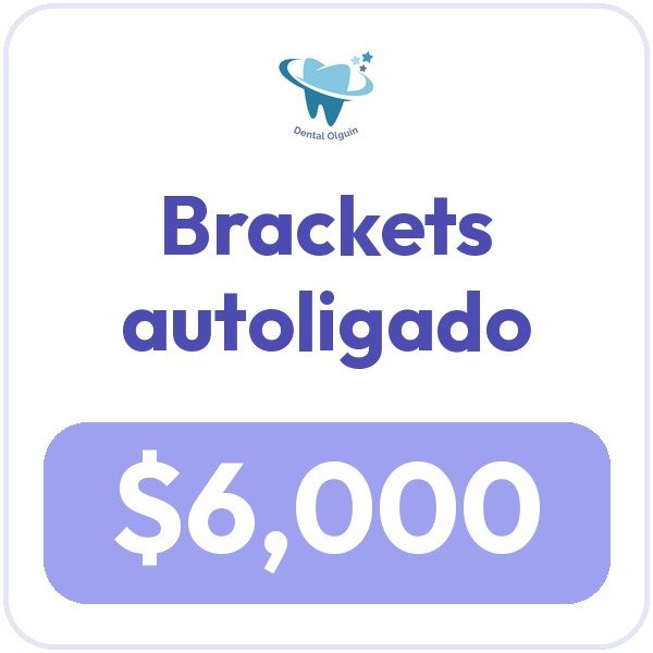 Promoción Brackets autoligado, $6,000.00